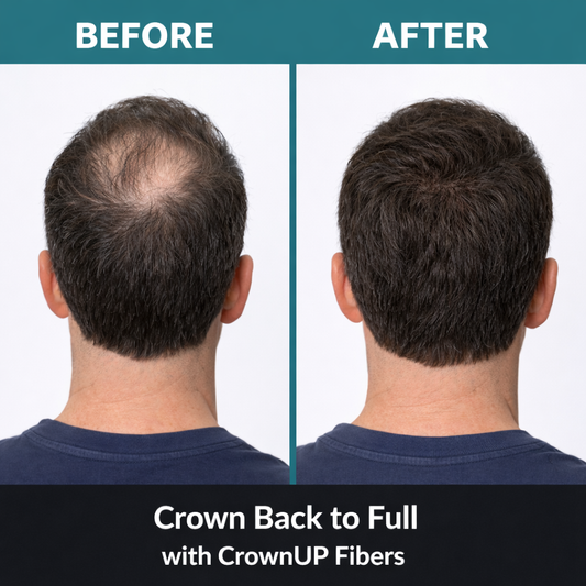 CrownUP Hair Building Fibers (Medium Brown 15g) Keratin Hair Thickener