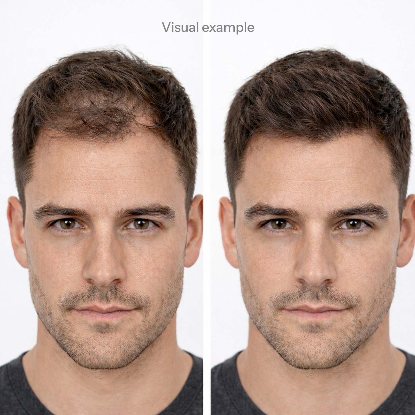 CrownUP Hair Building Fibers – Black 27.5g (Keratin Hair Thickener)